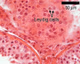 Article: Treatment of Low Testosterone from Grown Leydig Cells