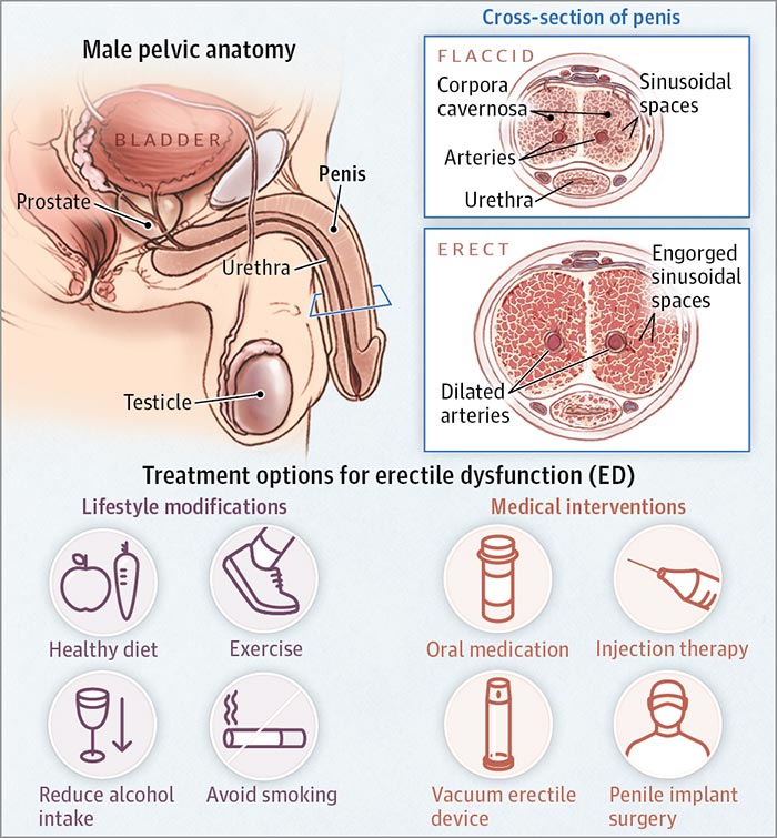 testosterone replacement therapy Calgary