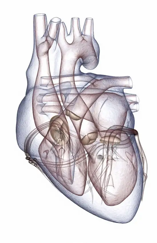 Heart health visualization
